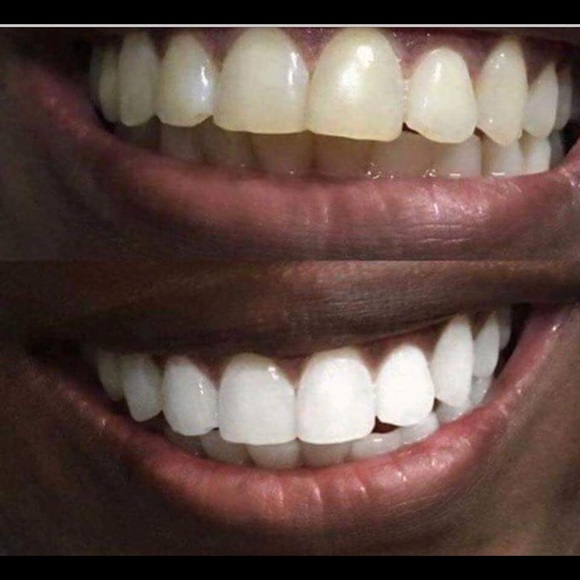 Whitening Toothpaste - Picture 4 of 6